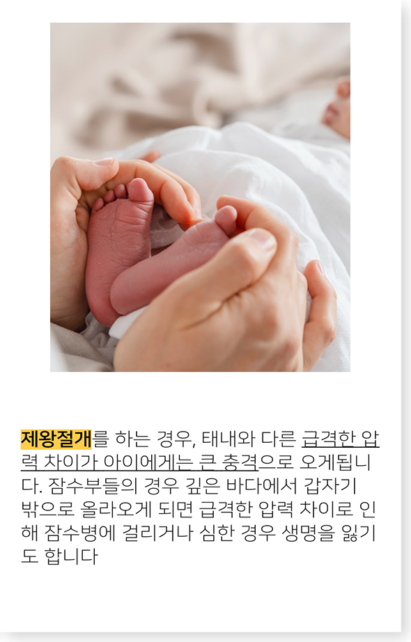 2. 부모가 아기의 발을 감싸고 있는 사진. 제왕절개 시 발생하는 급격한 압력 차이가 아기에게 큰 충격으로 다가와, 뇌의 구조적 비틀림 및 뇌불균형을 유발할 수 있다는 설명을 위한 이미지.